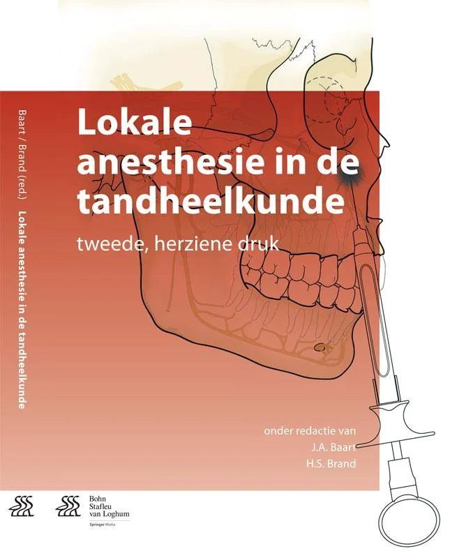 Lokale anesthesie in de tandheelkunde Goedkoop