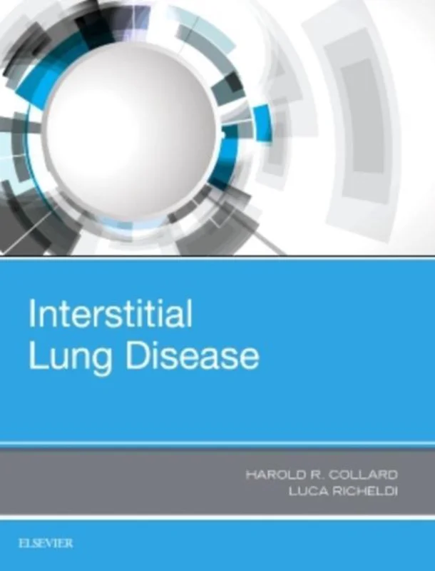 Populair Interstitial Lung Disease