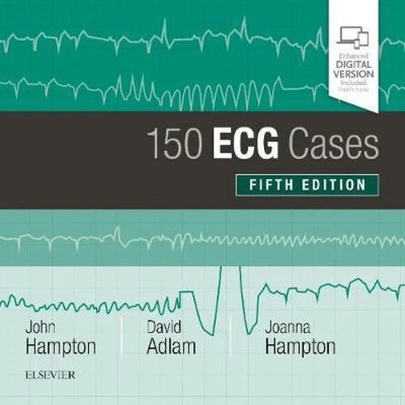 Op = Op 150 ECG Cases