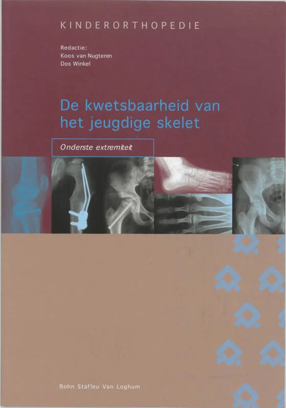 Speciale Aanbieding De kwetsbaarheid van het jeugdige skelet: onderste extremiteit / Orthopedische casuïstiek
